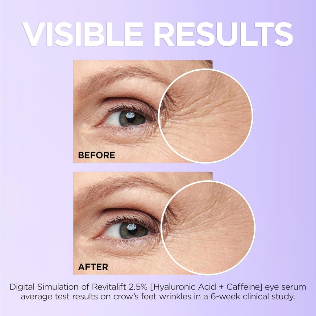 Top-Eye-Serums-for-Dark-Circles-in-2025